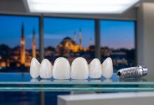 Un modèle d'implant dentaire et de facettes en céramique posé sur une surface en verre dans une clinique moderne, avec une vue floue et cinématographique d'Istanbul au crépuscule en arrière-plan.