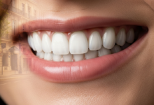 Close-up of a radiant, perfect smile with bright, healthy dental veneers. The background is a softly blurred Parisian street scene with classic French architecture.