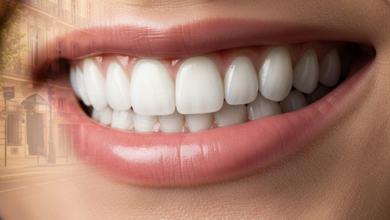 Close-up of a radiant, perfect smile with bright, healthy dental veneers. The background is a softly blurred Parisian street scene with classic French architecture.