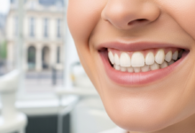 Close-up of a person's natural, healthy, and confident smile, showcasing perfectly aligned white teeth, set against a deeply blurred background of a modern dental clinic and a subtle, out-of-focus hint of French architecture. No text is visible.