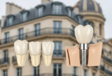 A close-up, photorealistic image comparing two dental prosthetics. On the left, a three-unit dental bridge with artificial teeth and crowns. On the right, a dental implant showing a screw-in post, an abutment, and a crown integrated into a stylized jawbone. The background is a soft, out-of-focus blur of elegant French architecture.