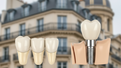 A close-up, photorealistic image comparing two dental prosthetics. On the left, a three-unit dental bridge with artificial teeth and crowns. On the right, a dental implant showing a screw-in post, an abutment, and a crown integrated into a stylized jawbone. The background is a soft, out-of-focus blur of elegant French architecture.
