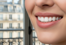 Close-up of a person's lower face showing a bright, confident smile with perfectly restored teeth. The background is a soft blur of a French cityscape seen through a window.