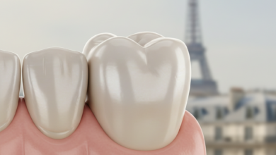 Close-up, photorealistic image of a natural-looking dental implant crown integrated into a clean gum line, with a softly blurred background showing a faint silhouette of the Eiffel Tower in Paris, France.