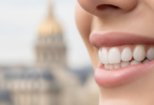 Close-up, photorealistic image of a perfect, bright white smile with natural-looking dental veneers, in sharp focus. The background is an extremely blurred, elegant Parisian street scene or iconic French architecture, illuminated by soft daylight.