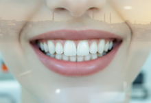 Un gros plan photoréaliste sur un sourire lumineux et des dents parfaitement blanches. L'arrière-plan est flou, montrant des éléments subtils d'une clinique dentaire moderne et, plus lointain, une silhouette urbaine estompée d'Istanbul sous un éclairage doux et ensoleillé.
