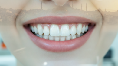 Un gros plan photoréaliste sur un sourire lumineux et des dents parfaitement blanches. L'arrière-plan est flou, montrant des éléments subtils d'une clinique dentaire moderne et, plus lointain, une silhouette urbaine estompée d'Istanbul sous un éclairage doux et ensoleillé.