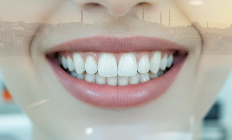 Un gros plan photoréaliste sur un sourire lumineux et des dents parfaitement blanches. L'arrière-plan est flou, montrant des éléments subtils d'une clinique dentaire moderne et, plus lointain, une silhouette urbaine estompée d'Istanbul sous un éclairage doux et ensoleillé.