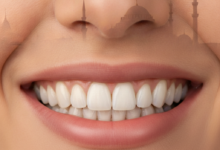 Gros plan photoréaliste d'un sourire sain et parfait avec des dents blanches, en arrière-plan flou la silhouette reconnaissable d'Istanbul, Turquie, avec ses dômes et minarets.