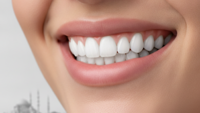 Gros plan sur un sourire éclatant avec des dents parfaitement alignées et blanches, avec en arrière-plan flou la silhouette reconnaissable d'Istanbul, en Turquie.