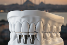 Une image photoréaliste d'une représentation conceptuelle d'une mâchoire dentaire restaurée, avec des dents propres et alignées, symbolisant la technique All-on-4. En arrière-plan flou, se dessine une vue atmosphérique d'une ville turque, comme Istanbul, au coucher du soleil, avec ses minarets et son plan d'eau. L'image est lumineuse, moderne et dégage une sensation de bien-être et de confiance.