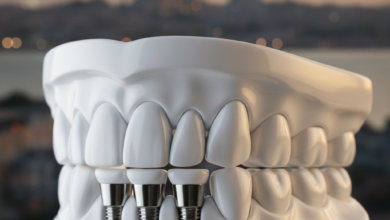 Une image photoréaliste d'une représentation conceptuelle d'une mâchoire dentaire restaurée, avec des dents propres et alignées, symbolisant la technique All-on-4. En arrière-plan flou, se dessine une vue atmosphérique d'une ville turque, comme Istanbul, au coucher du soleil, avec ses minarets et son plan d'eau. L'image est lumineuse, moderne et dégage une sensation de bien-être et de confiance.