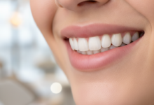 Gros plan d'un sourire sain et confiant avec des dents impeccables et naturelles, dans un environnement de clinique dentaire moderne et flou. L'image évoque le succès et l'esthétique des implants dentaires.
